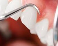 با درمان ریشه دندان از عفونت های مزمن جلوگیری کنید